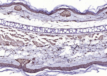 p73 antibody