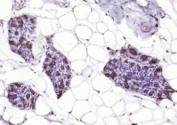 p73 antibody