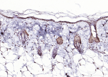 p73 antibody