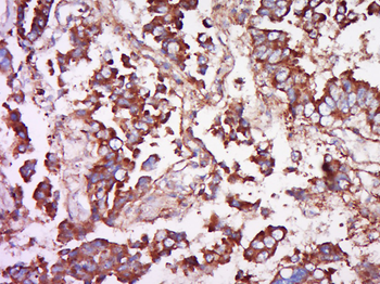 PAR-1 antibody