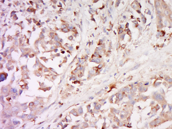 PAR-1 antibody