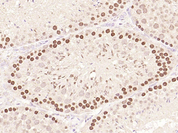 PCNA antibody