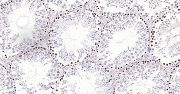 PCNA antibody