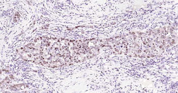 PCNA antibody