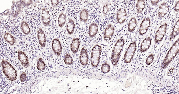 PCNA antibody