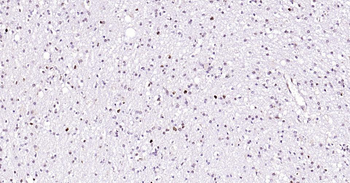 PCNA antibody