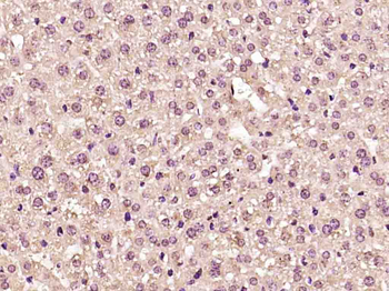 AKT antibody