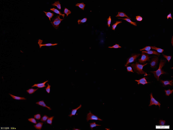 AKT antibody