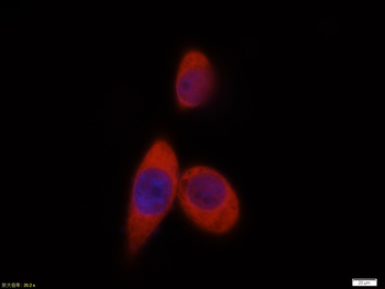 AKT antibody