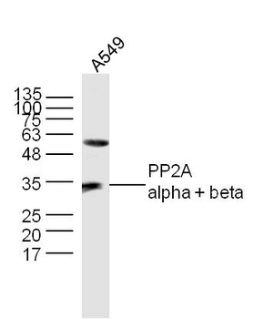 PP2A alpha antibody