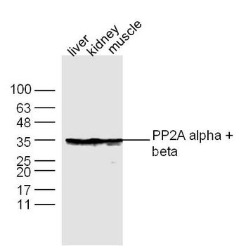 PP2A alpha antibody