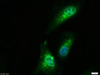 PPAR gamma antibody