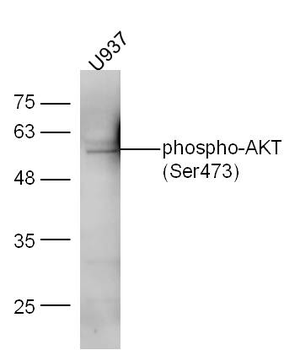 AKT (phospho-Ser473) antibody