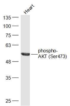 AKT (phospho-Ser473) antibody