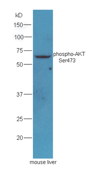 AKT (phospho-Ser473) antibody