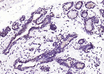 RAR beta antibody