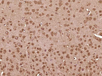 RAR beta antibody