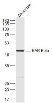 RAR beta antibody