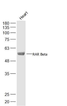 RAR beta antibody