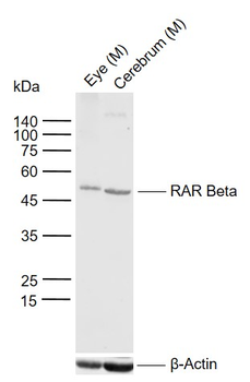 RAR beta antibody