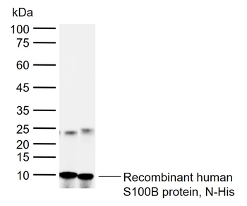 S100B antibody