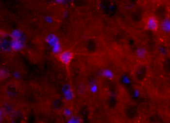 S100B antibody