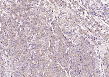 CRIM1 antibody