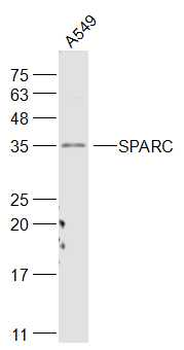 SPARC antibody