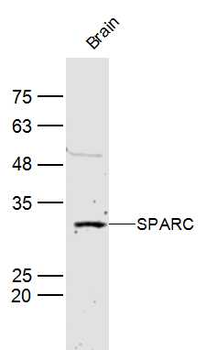 SPARC antibody