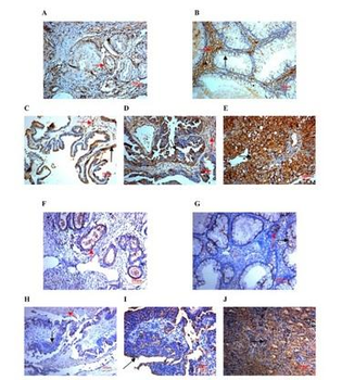 SPARC antibody