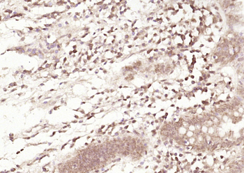 SPARC antibody