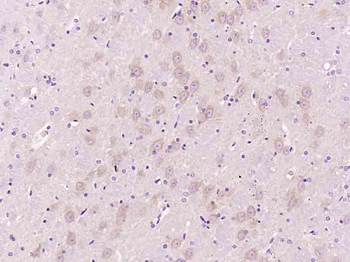 SPARC antibody