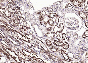 SYVN1 Rabbit Polyclonal Antibody