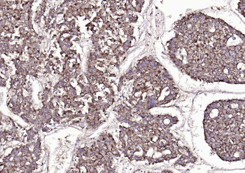 SYVN1 antibody