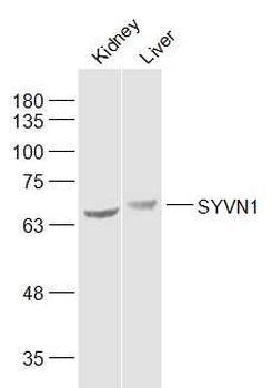 SYVN1 antibody