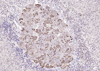 RARRES2 antibody