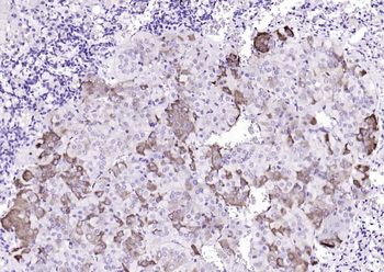 RARRES2 antibody