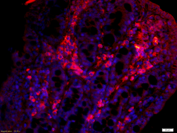 RARRES2 antibody