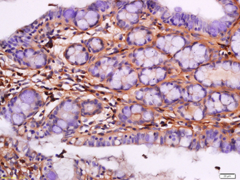 RARRES2 antibody