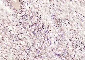 p53 (acetyl-Lys382) antibody