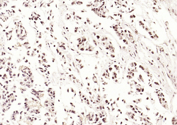 p53 (acetyl-Lys382) antibody