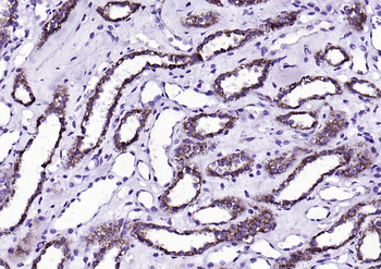 Fumarase/FH antibody