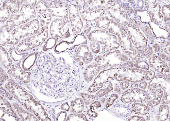 Fumarase/FH antibody