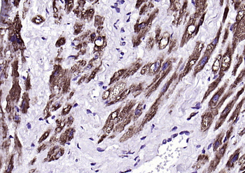 Fumarase/FH antibody