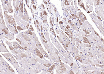 Fumarase/FH antibody