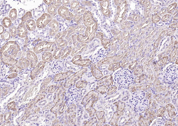 Cathepsin L antibody