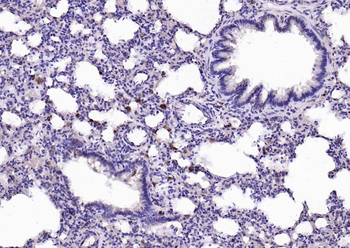 Cathepsin L antibody