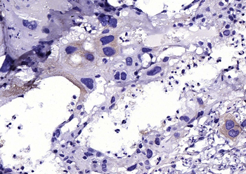 Cathepsin L antibody