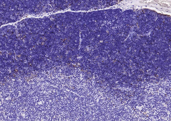 Cathepsin L antibody