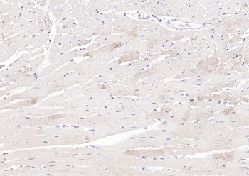 Cathepsin L antibody